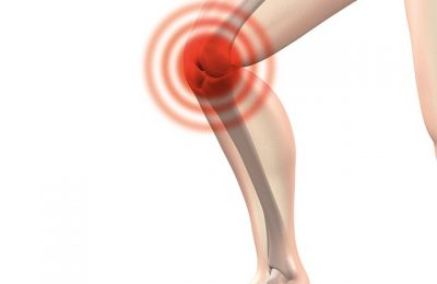 Reconnaître 8 causes de douleur au genou et premiers soins